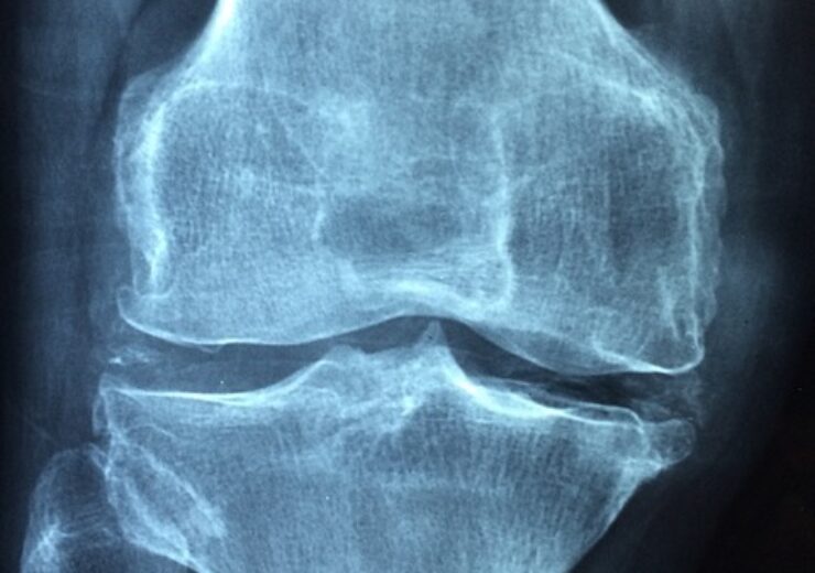 Zimmer, Canary get FDA de novo authorisation for smart knee implant