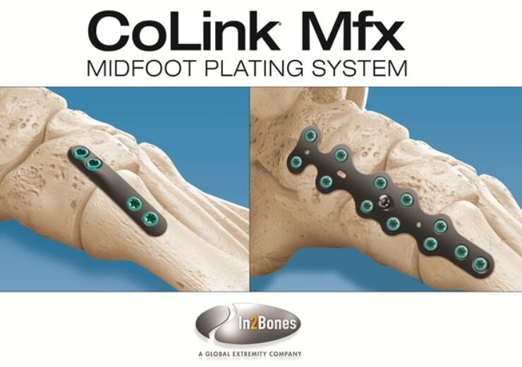 In2Bones Introduces CoLink Mfx Midfoot Plating System