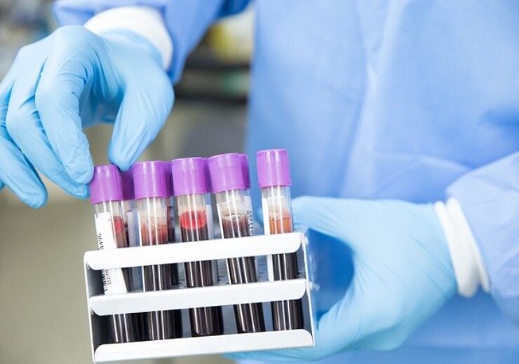 UK’s NHS begins new blood test trial to detect 50 cancer types