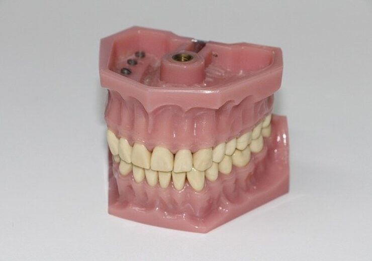 dental-prosthesis-1514697_640