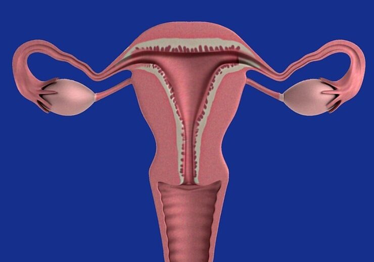 Gynesonics gets FDA nod for new-generation Sonata System to treat uterine fibroids