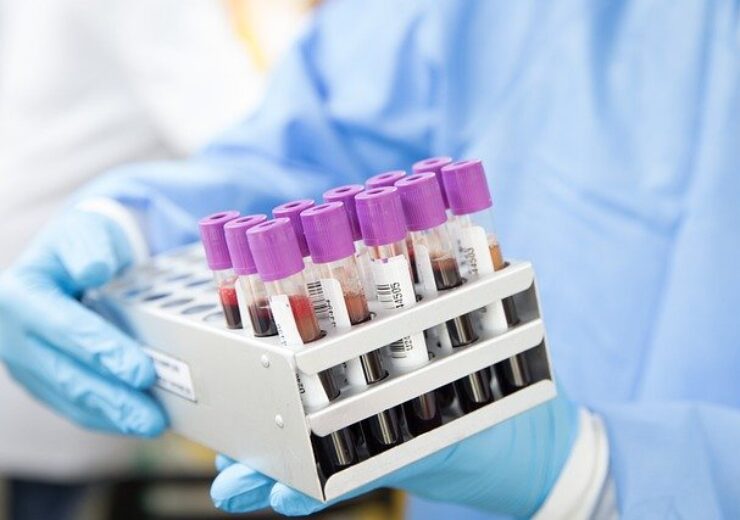 Study shows Guardant Health’s blood test ability to detect early-stage colorectal cancer