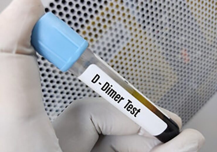 D-dimer test still helpful to rule out pulmonary embolisms in hospitalized COVID-19 patients