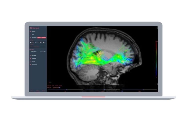 FDA approves Advantis Medical’s neuroimaging platform Brainance MD