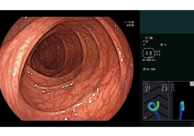 Fujifilm introduces real-time endoscope visualisation system ColoAssist PRO