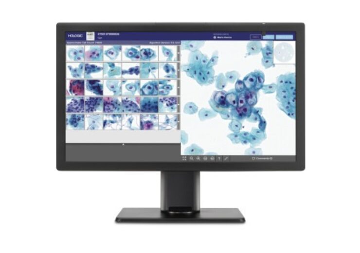 Hologic launches Genius Digital Diagnostics System in Europe