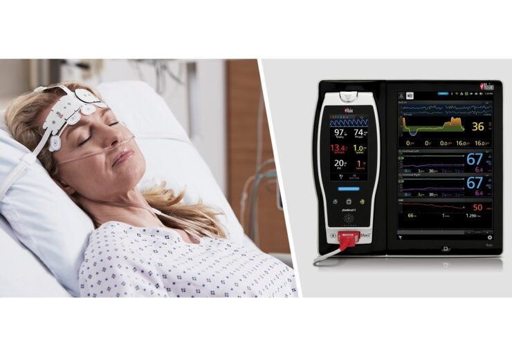 Masimo Root with Multimodal Brain Monitoring Algorithm May Improve Postoperative Neurocognition in Elderly Patients