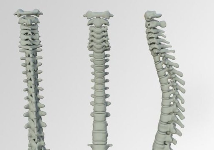 Theradaptive’s Osteo-Adapt SP spinal fusion implant gets FDA breakthrough status