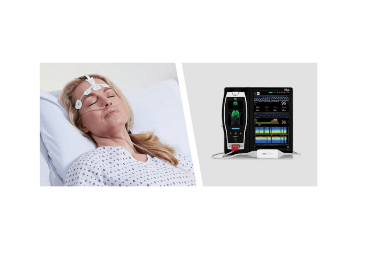 New Study Suggests That Masimo SedLine Brain Function Monitoring May Aid Early Identification of Patients at Risk of Developing Postoperative Delirium