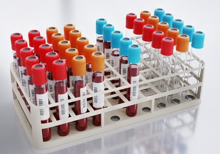 blood-collection-g362b4ea02_640