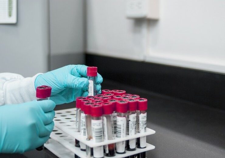 Qiagen, Denovo to develop blood-based CDx test for lymphoid cancer
