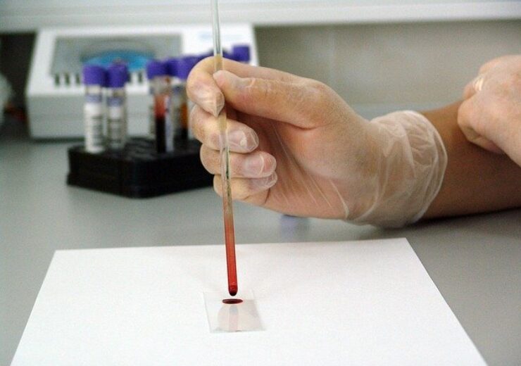Diadem gets FDA breakthrough status for blood test to detect Alzheimer’s