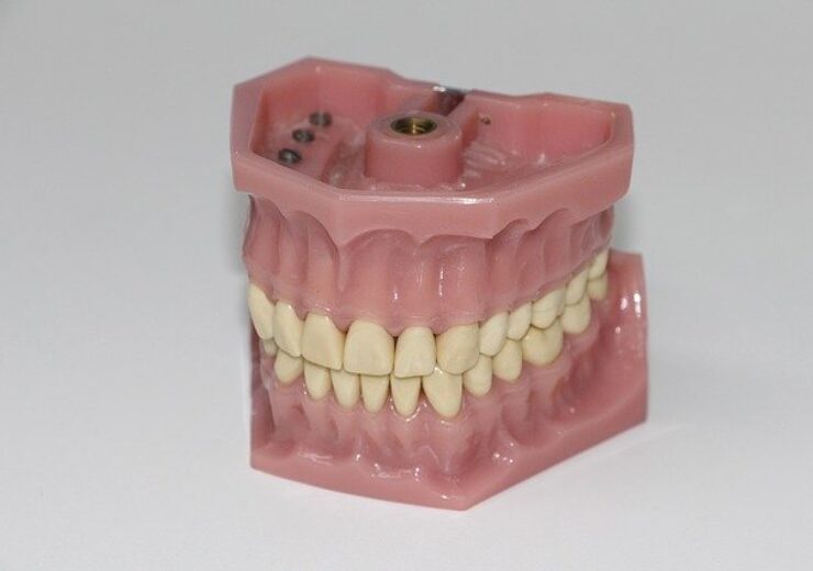 dental-prosthesis-gb4102919a_640