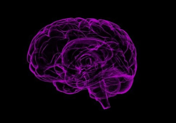 Viz.ai gets FDA nod for AI-based algorithm to detect cerebral aneurysms