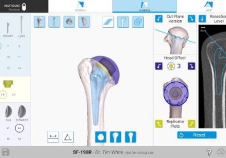 Exactech Smart Shoulder Technology Now Features Humeral Planning and Joint Motion