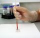 Datar gets breakthrough status for prostate cancer detection blood test