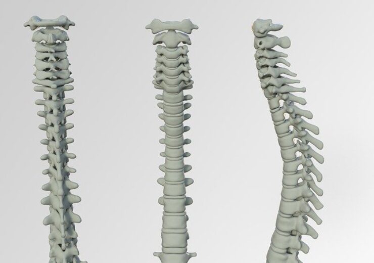DeGen Medical introduces new 3D-printed spinal implant