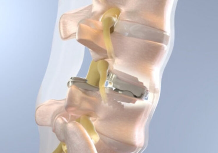 3Spine-sectional