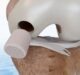 FDA approves CartiHeal’s Agili-C implant to treat cartilage and osteochondral defects