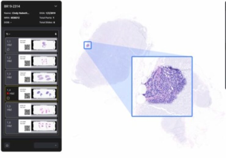 Paige unveils AI software to detect breast cancer metastases in lymph nodes