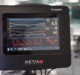 The Argos Cardiac Output Monitor Interface is Declared Compatible with Philips IntelliBridge