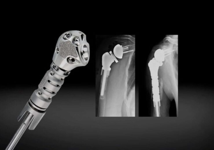 news_Exactech-Announces-Launch-of-Humeral-Reconstruction-Prosthesis-in-Europe_Hero
