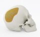 National Institutes of Health awards grant to Sintx Technologies for development of 3d printed Craniomaxillofacial Devices