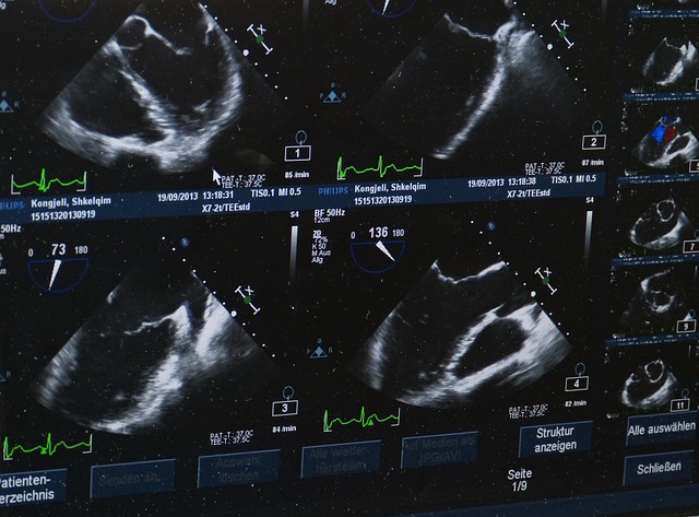 NovaSignal Receives Health Canada Approval for the NovaGuide™ Intelligent Ultrasound
