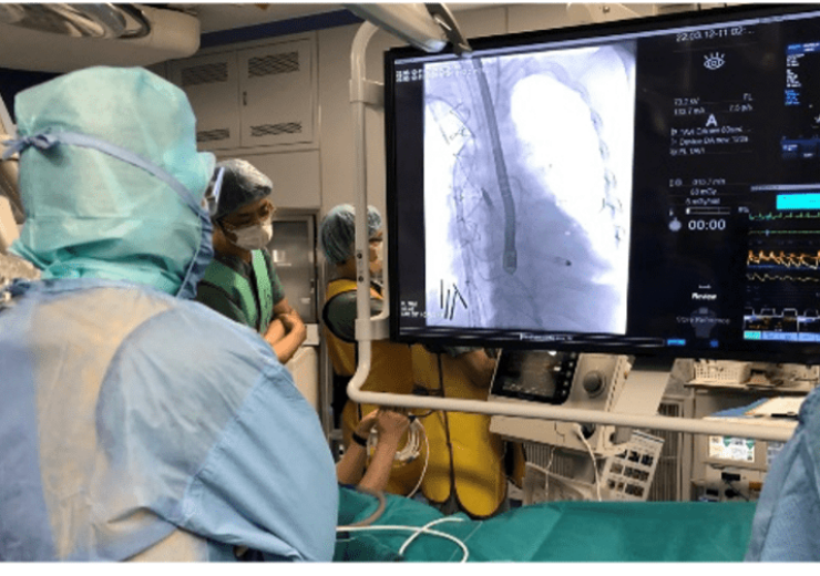 First Patient in Japan Treated with Impella 5.5 with SmartAssist
