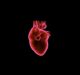 Abbott gets FDA nod for Aveir leadless pacemaker to treat slow heart rhythms