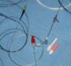 FDA clearance granted for new dual lumen catheter