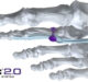 Paragon 28 launches TenoTac 2.0 Soft Tissue Stabilization System for Hammertoe and soft tissue repair