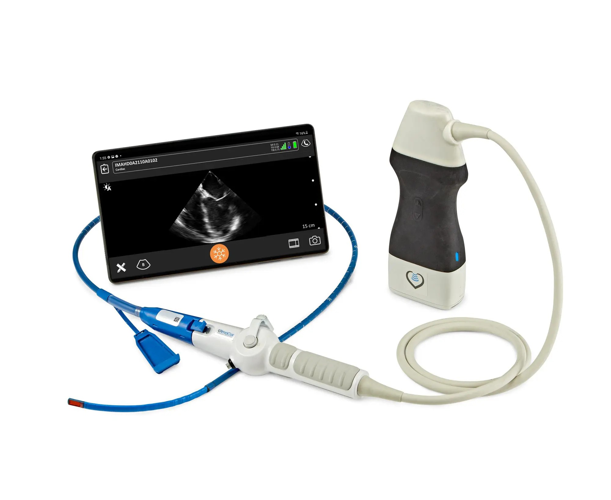 The Zura Handheld Hemodynamic Ultrasound system powered by Clarius provides an instant, clear window to directly visualize preload and contractility over time. (Credit: Clarius)