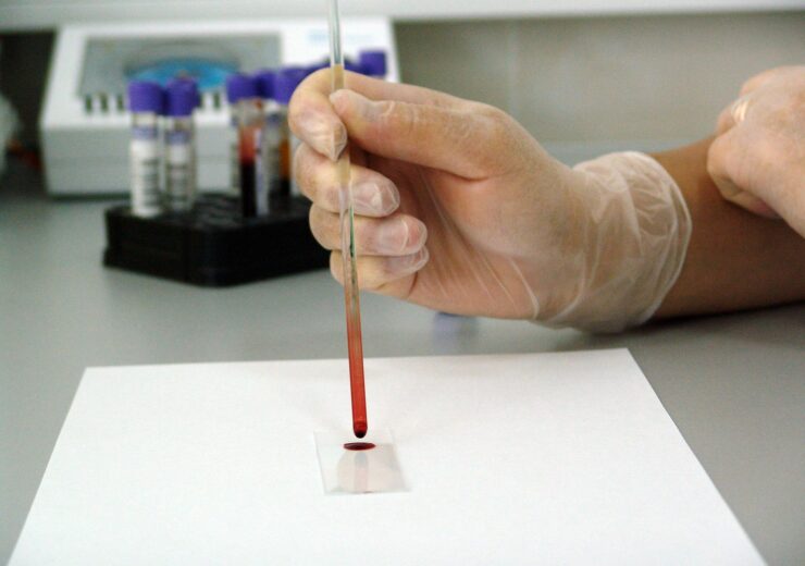 Burning Rock obtains CE mark for OverC multi-cancer detection blood test kit