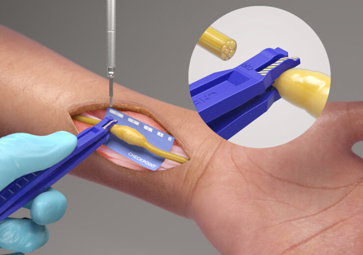 Checkpoint Surgical expands nerve care portfolio with new nerve cutting kit