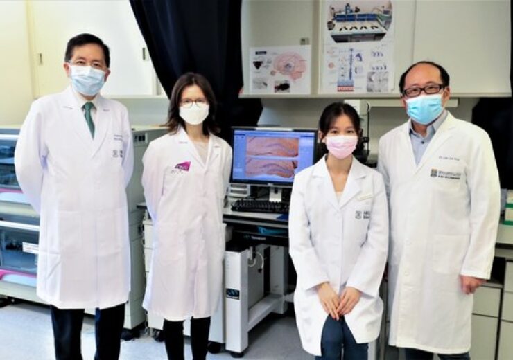 HKUMed and CityU researchers find positive results from stimulation of eye