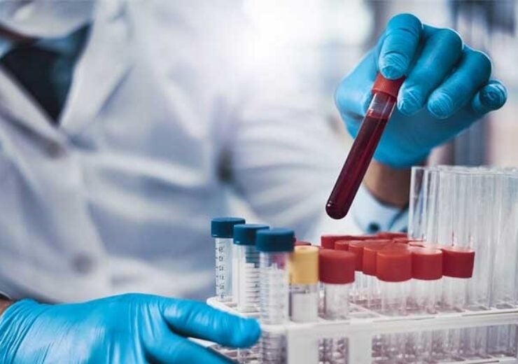 Labcorp rolls out new blood test to detect neurodegenerative disease