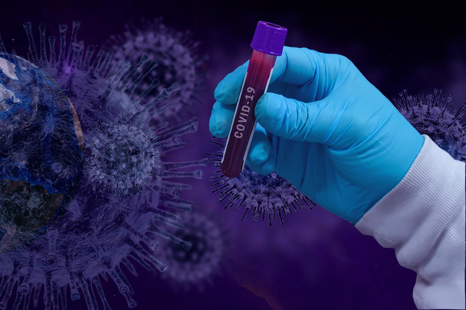 Predicine gets FDA EUA for SARS-CoV-2 RT-PCR and self-collection kit