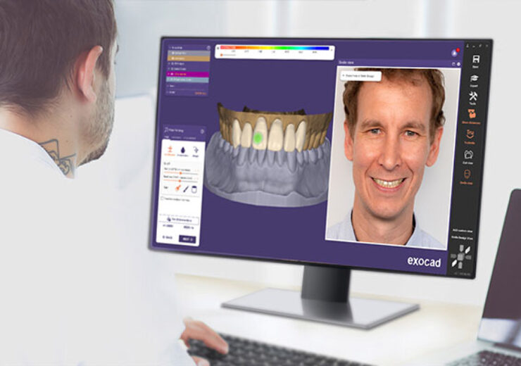 exocad introduces DentalCAD 3.1 Rijeka software with 45 new features for a simplified design journey