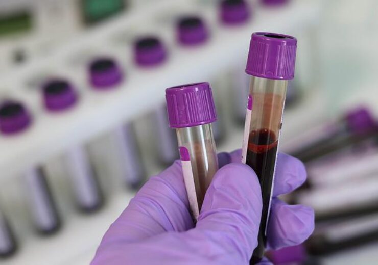 With just a tablespoon of blood, B.C. researchers aim to transform cancer treatment