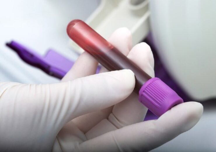 3 Aug blood test brain tumour - article