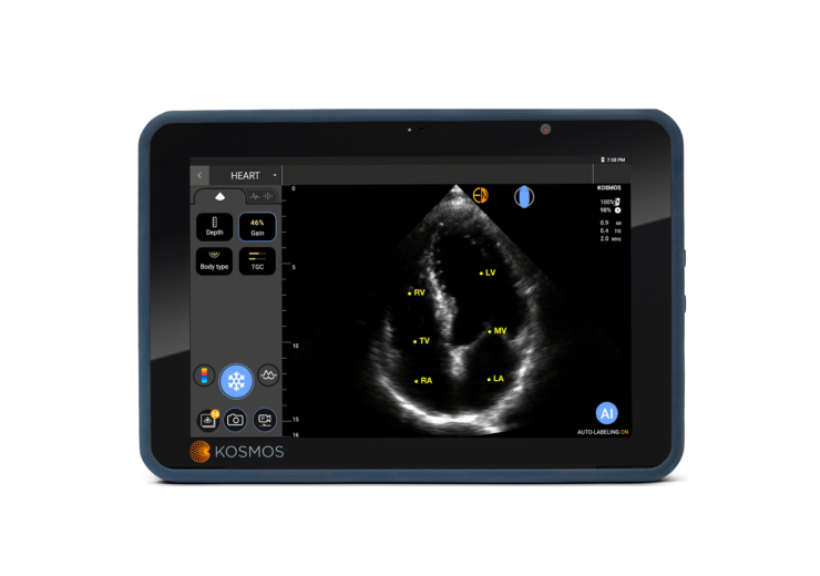 EchoNous to upgrade Kosmos platform with Samsung Galaxy tablets