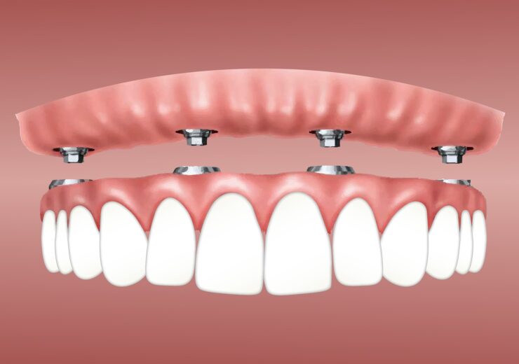 orthobrain Announces Launch of SimplyClear Aligner System