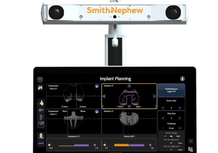 Smith+Nephew first to market with revision knee indication on robotics platform