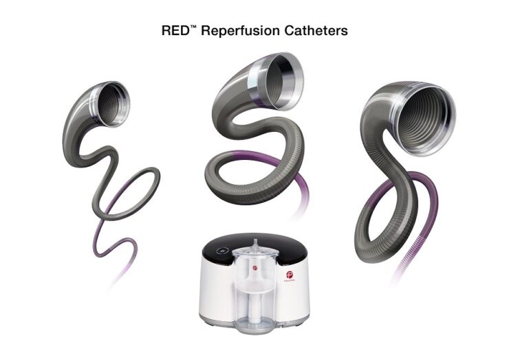 Penumbra Announces European Launch of RED Reperfusion Catheters for Stroke Care