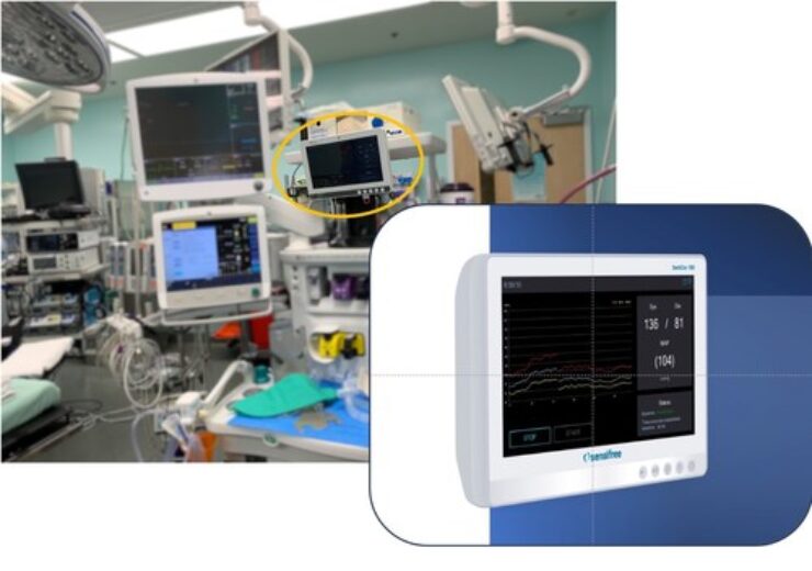 Sensifree Wins CE Certification for SentiCor-100 Continuous Non-Invasive Blood Pressure Monitor