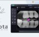 SOTA’s Dental Imaging Software Gets Pearl’s AI Pathology Detection Capabilities