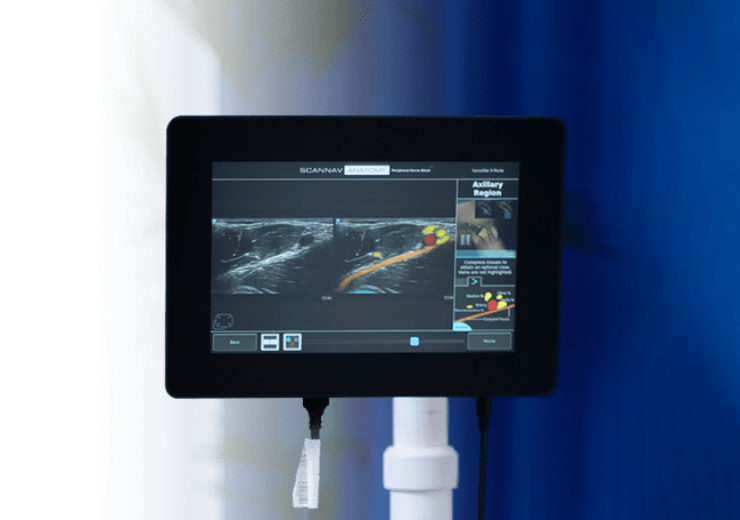 Intelligent Ultrasound gets FDA De Novo approval for ScanNav Anatomy PNB device