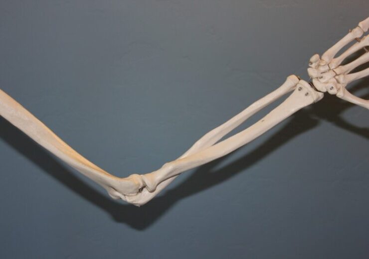skeleton-ga440e8b16_1920