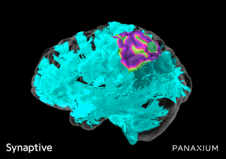 Synaptive, Panaxium partner to bring cortical mapping to neurosurgical procedures